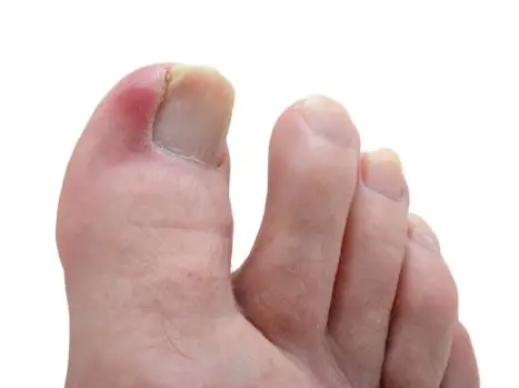 Why do humans have toenails